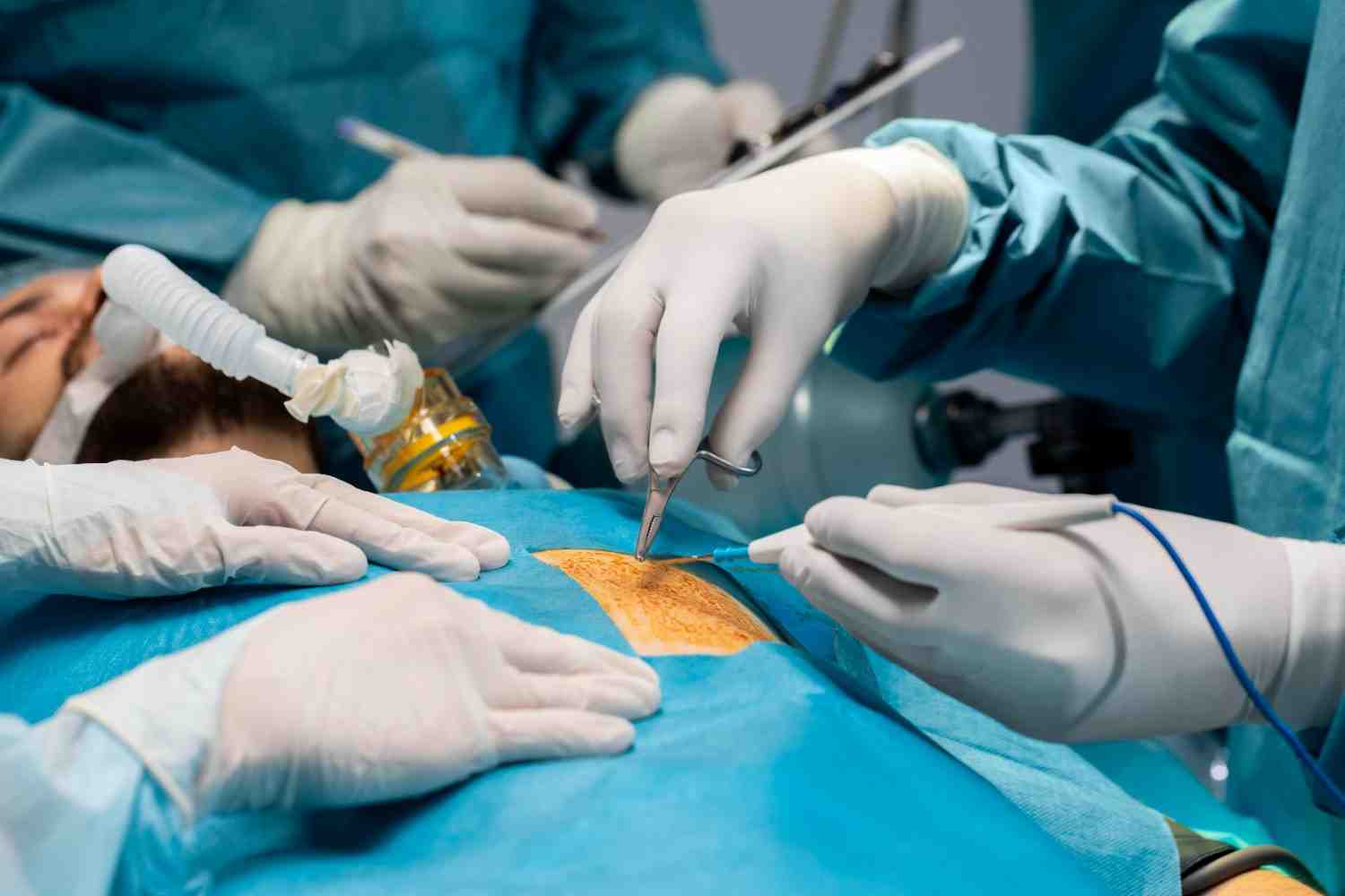 Superior Laparoscopic Surgery in Islamabad Clinics