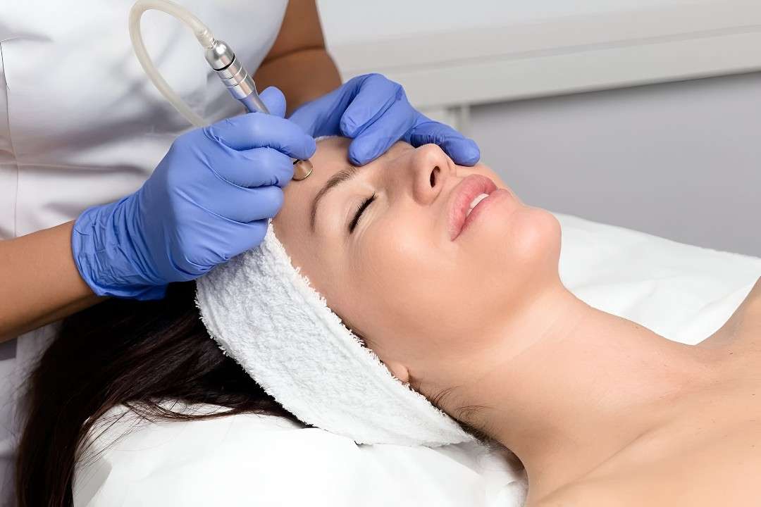 Microdermabrasion in Islamabad: Perfect Your Skin
